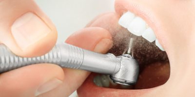 Close up of dentist hand drilling the teeth and spraying the water